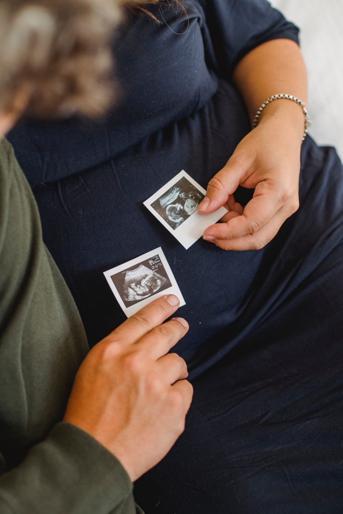 ventre de femme enceinte avec photo d'échographie caroline angin doula 